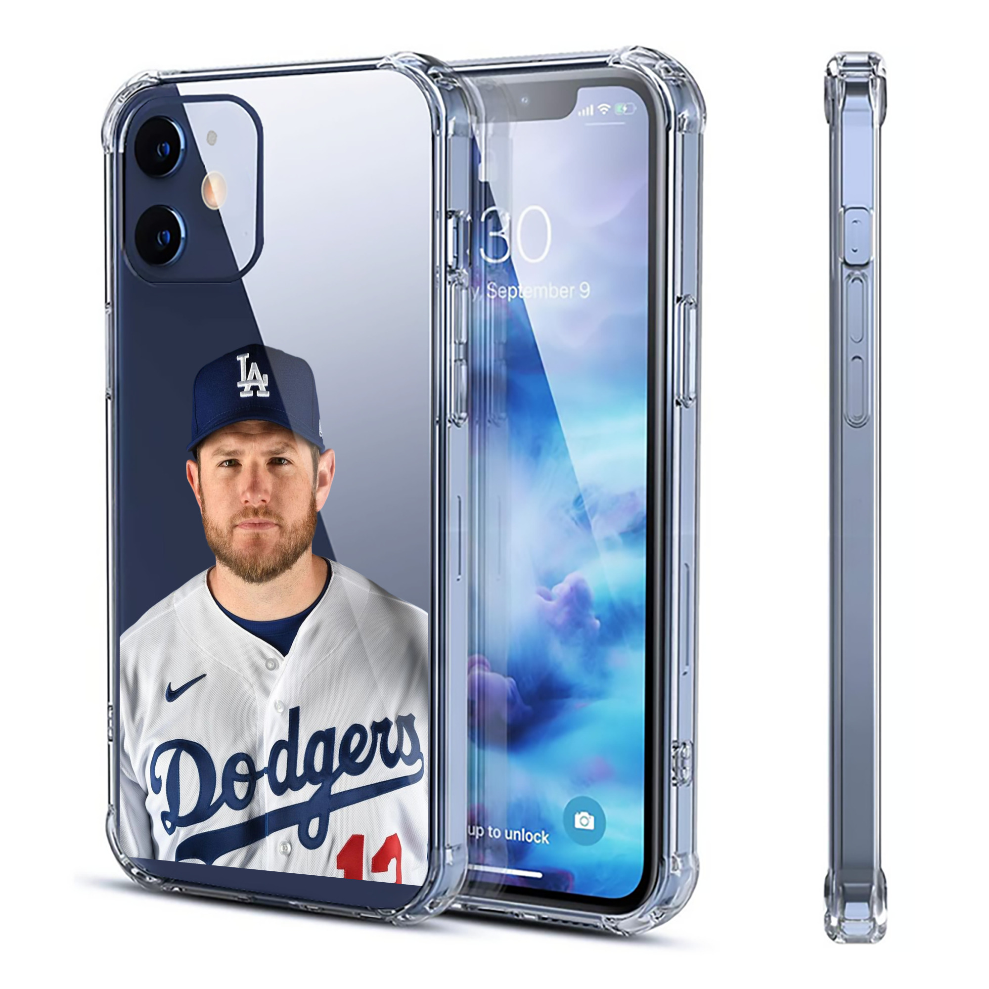  Clear IPhone 12 Case – Soft TPU With UV Print – Enhanced Drop Protection, Precise Fit, Anti-Fingerprint, Customizable Design, Scratch-Resistant, Yellow-Resistant